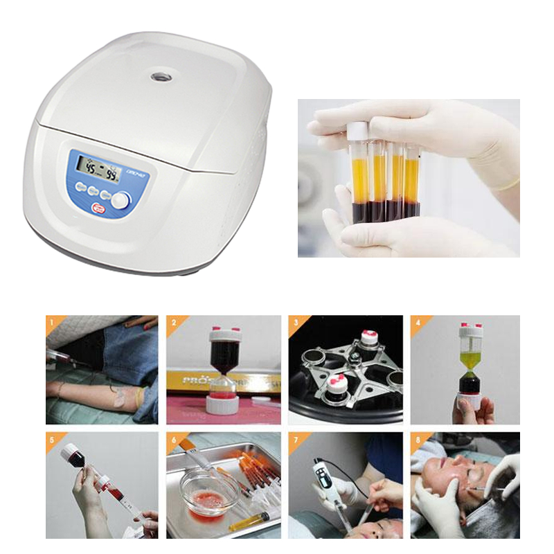Centrifuga medica per PRP, PRF - Medical Lab Center recensione e prezzo